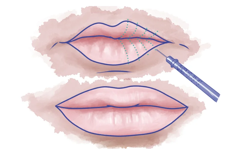 Lips Vectors Clipart  Illustrations for Free Download  illustAC