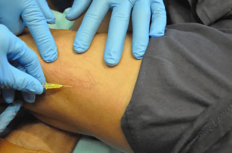 Sclerotherapy Training Photo Gallery 4