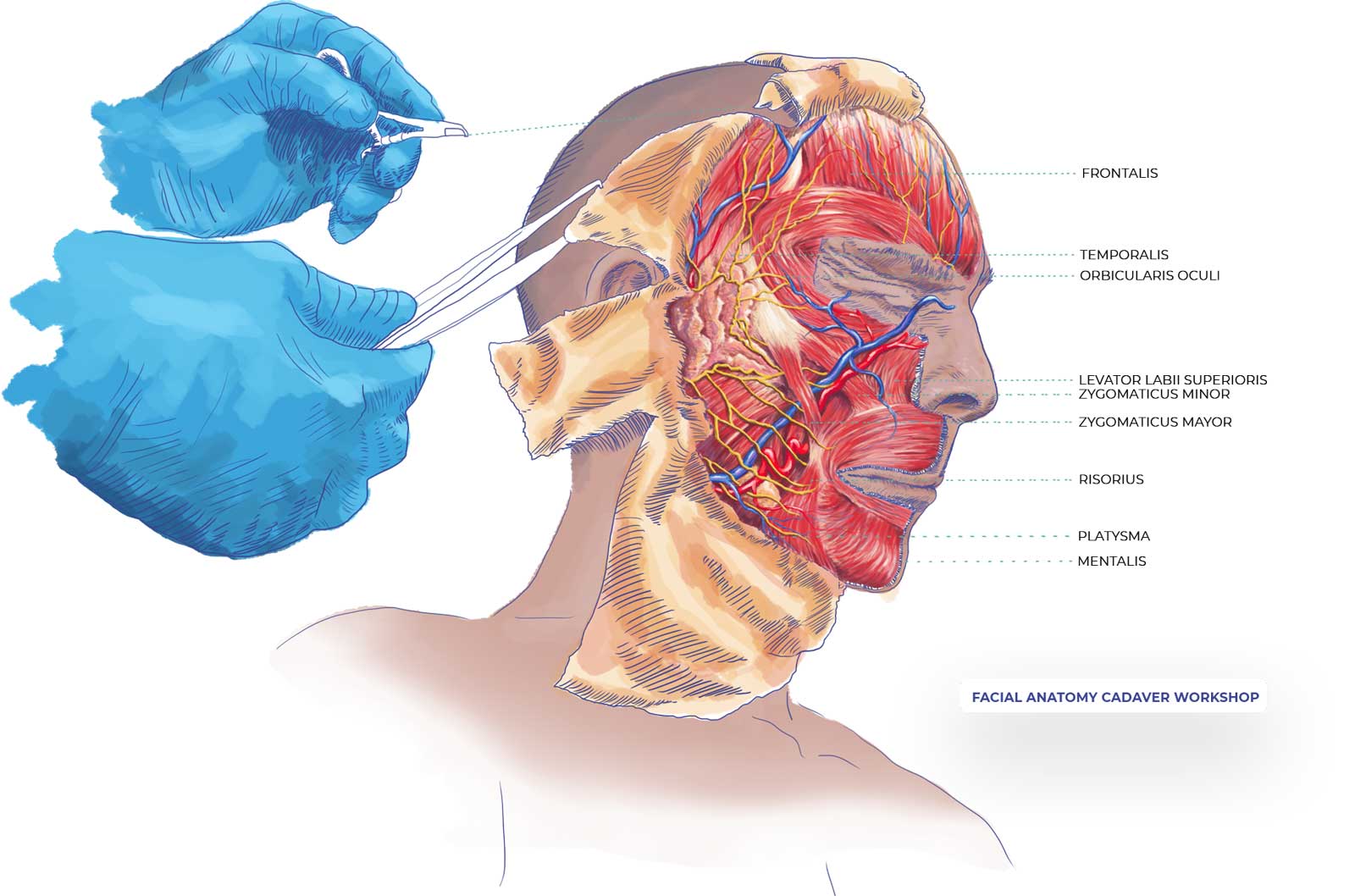 facial-anatomy-cadaver-workshop-illustration-after