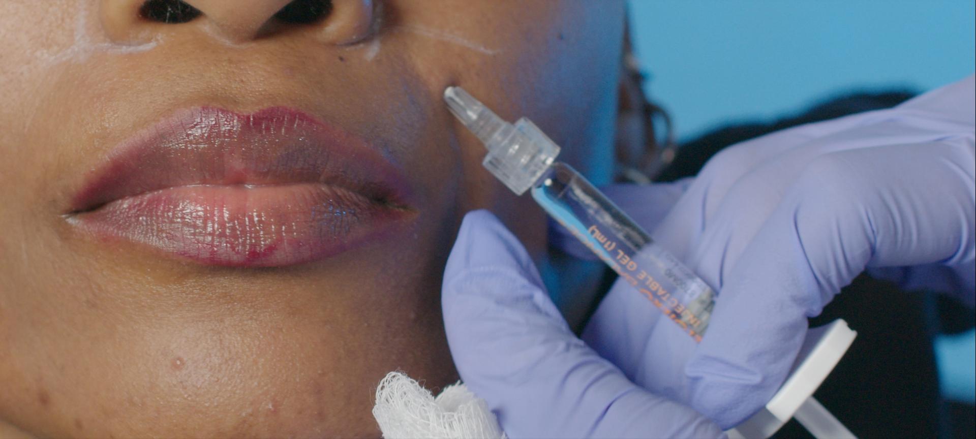 Does Needle Size Matter in Facial Injection Procedures?