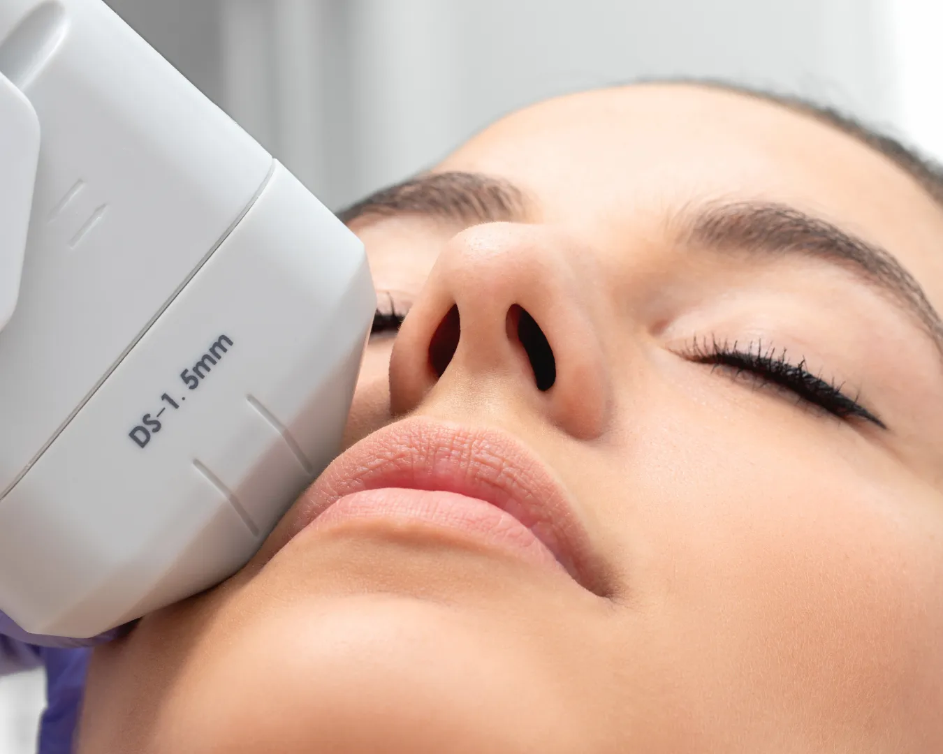 advanced-cosmetic-laser-photo-gallery-1