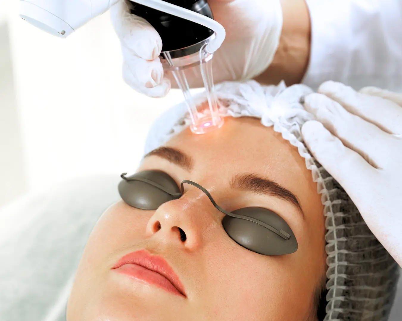 advanced-cosmetic-laser-photo-gallery-8