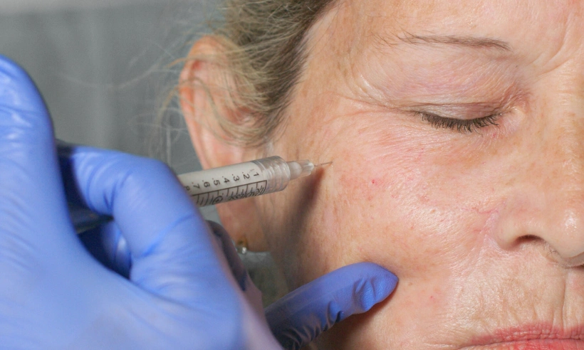 advanced botox and dermal filler training photo gallery 1