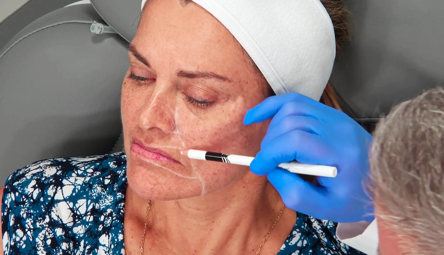 advanced masterclass program in facial harmonization overview 3