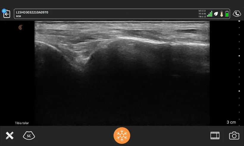 advanced-musculoskeletal-ultrasound-photo-gallery-7