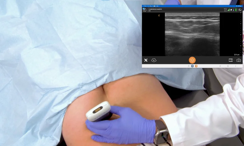 advanced-ultrasound-for-pain-management-level-ii-photo-gallery-2