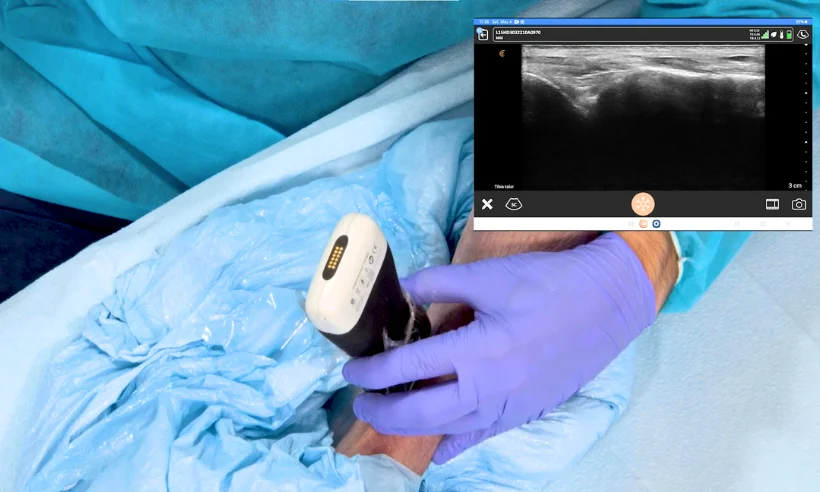 advanced-ultrasound-for-pain-management-level-ii-photo-gallery-4