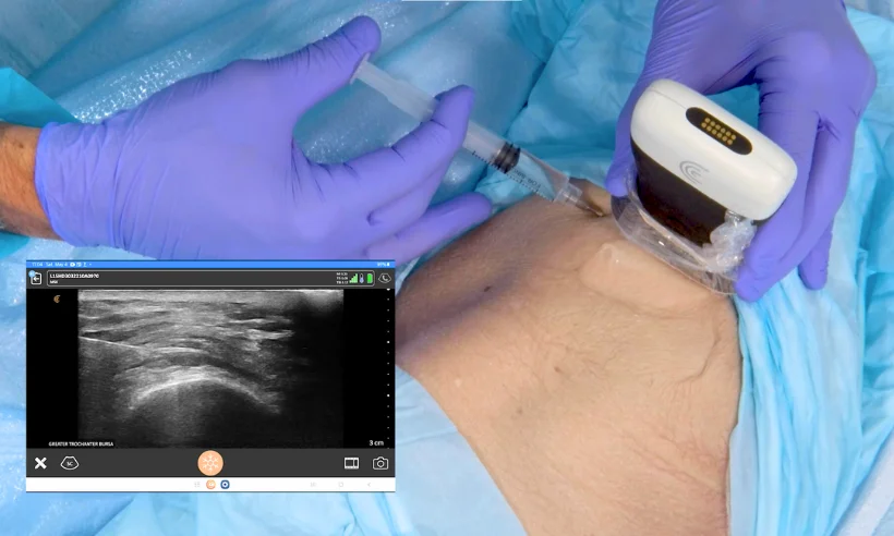 advanced-ultrasound-for-pain-management-level-ii-photo-gallery-5