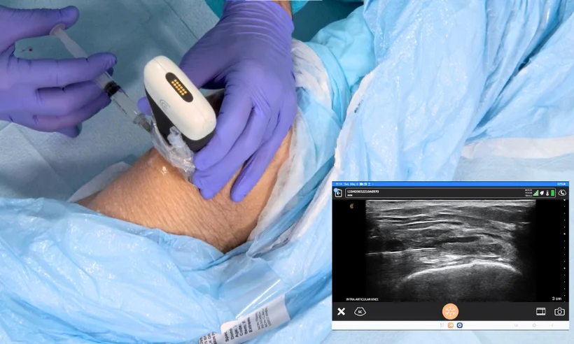 advanced-ultrasound-for-pain-management-level-ii-photo-gallery-7