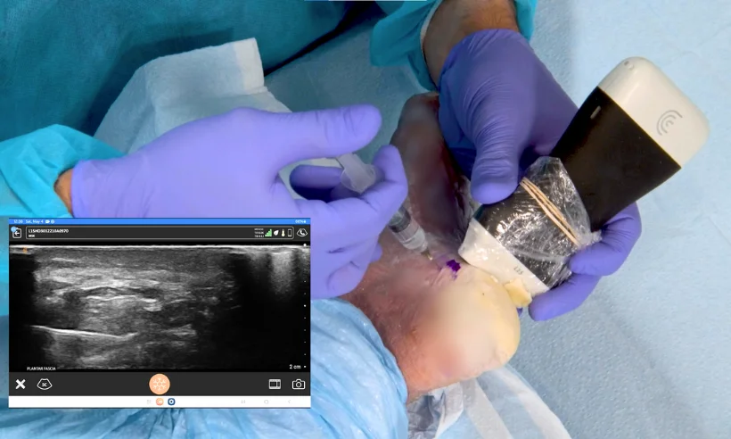 advanced-ultrasound-for-pain-management-level-ii-photo-gallery-9