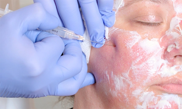 dermal filler training photo gallery 1